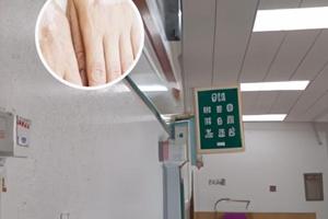 白點(diǎn)癲風(fēng)引起原因是什么病